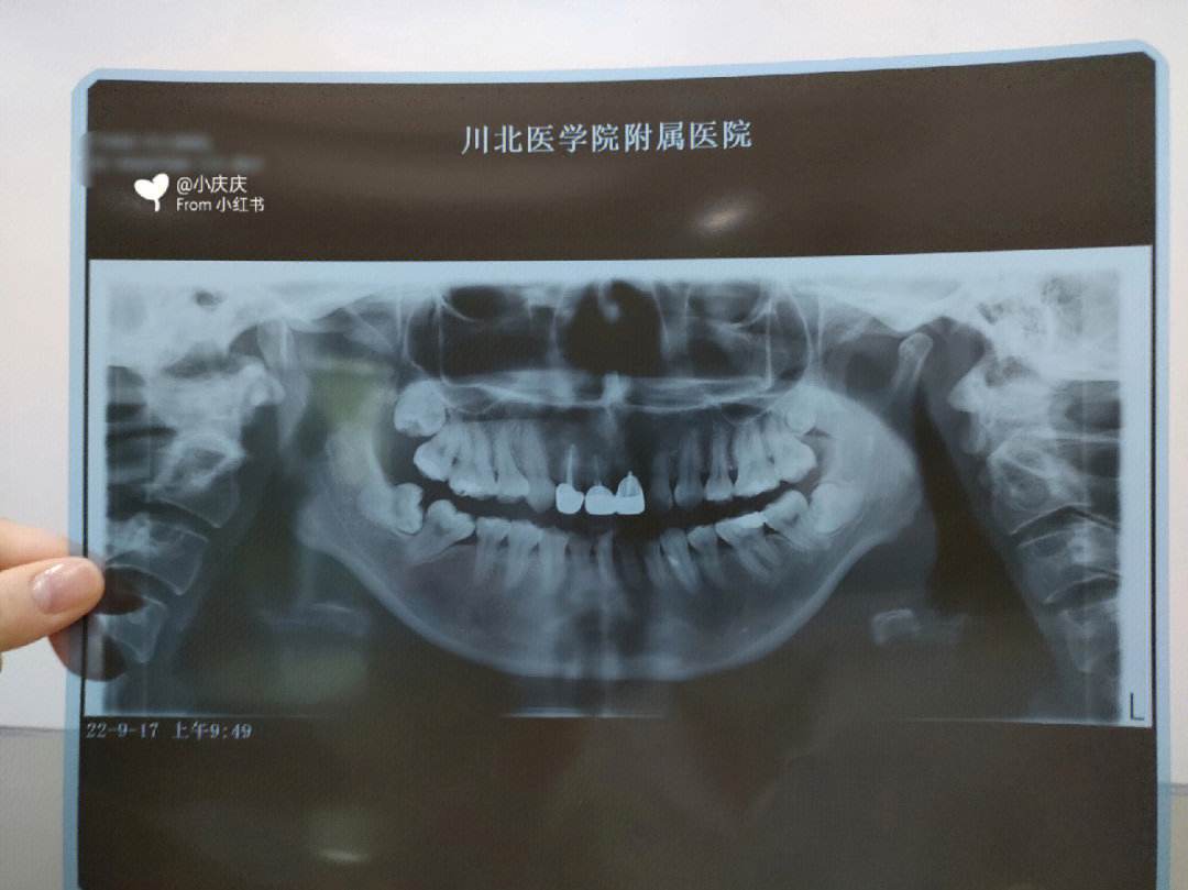 南充口腔医院(南充口腔医院是公立还是私立)